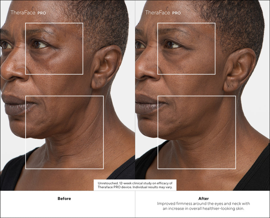 EAN 0810036056748 - Therabody TheraFace PRO masajeador Cara Negro imagen 10