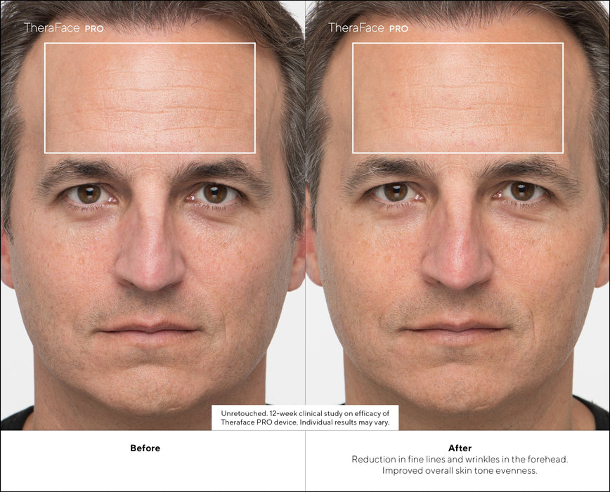 EAN 0810036056748 - Therabody TheraFace PRO masajeador Cara Negro imagen 11