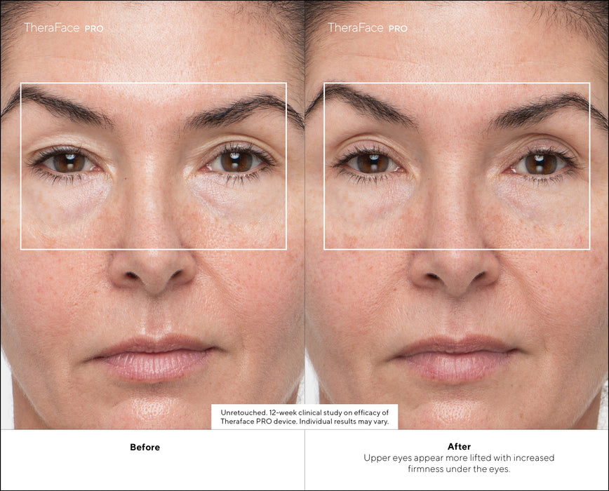 EAN 0810036056748 - Therabody TheraFace PRO masajeador Cara Negro imagen 12