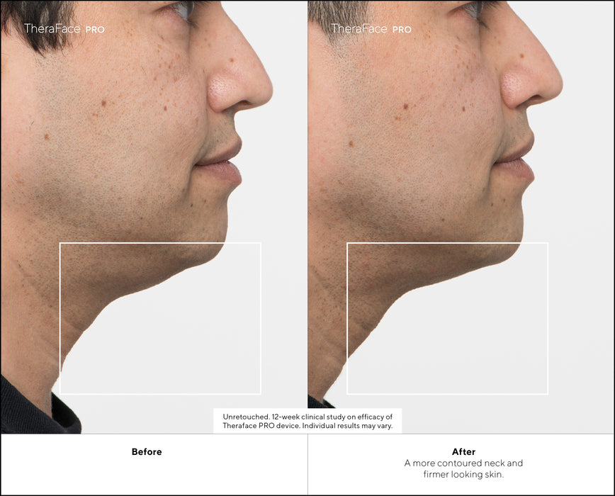 EAN 0810036056748 - Therabody TheraFace PRO masajeador Cara Negro imagen 9